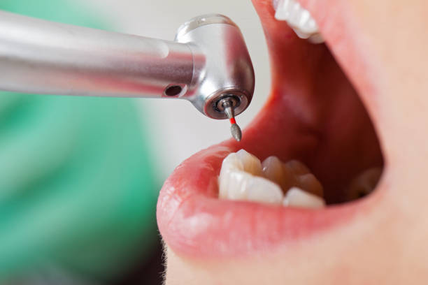 Best Emergency Treatment for Toothache in Afton, MN
